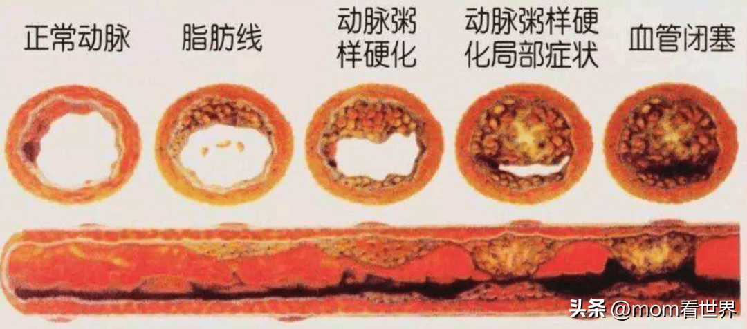 验血TG是什么-验血TG是什么意思