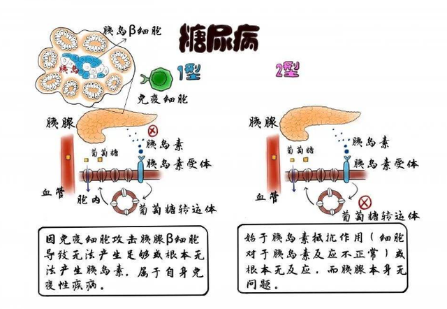 为什么糖尿病患者常伴有TG升高的简单介绍