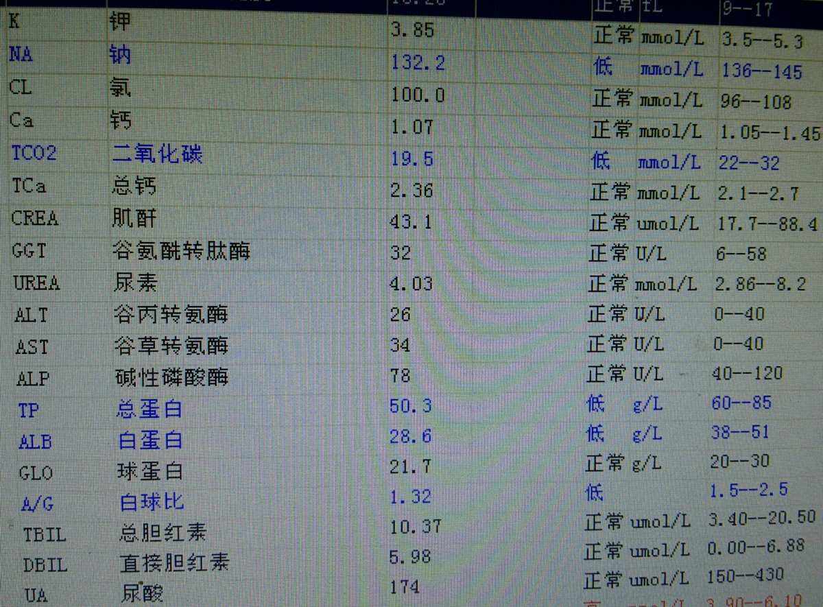 血生化TG-血生化TG正常值