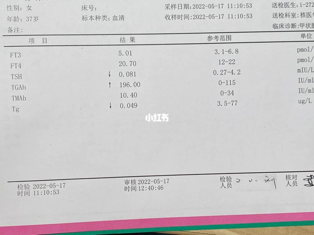 TSH和TG升高的简单介绍